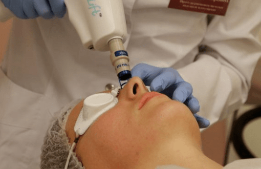 Uninformed laser rejuvenation